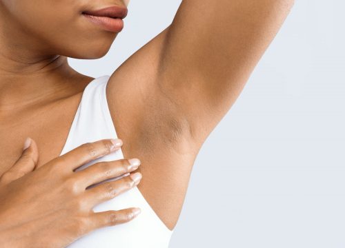 Woman's hairless armpit after Fotona Hair Removal
