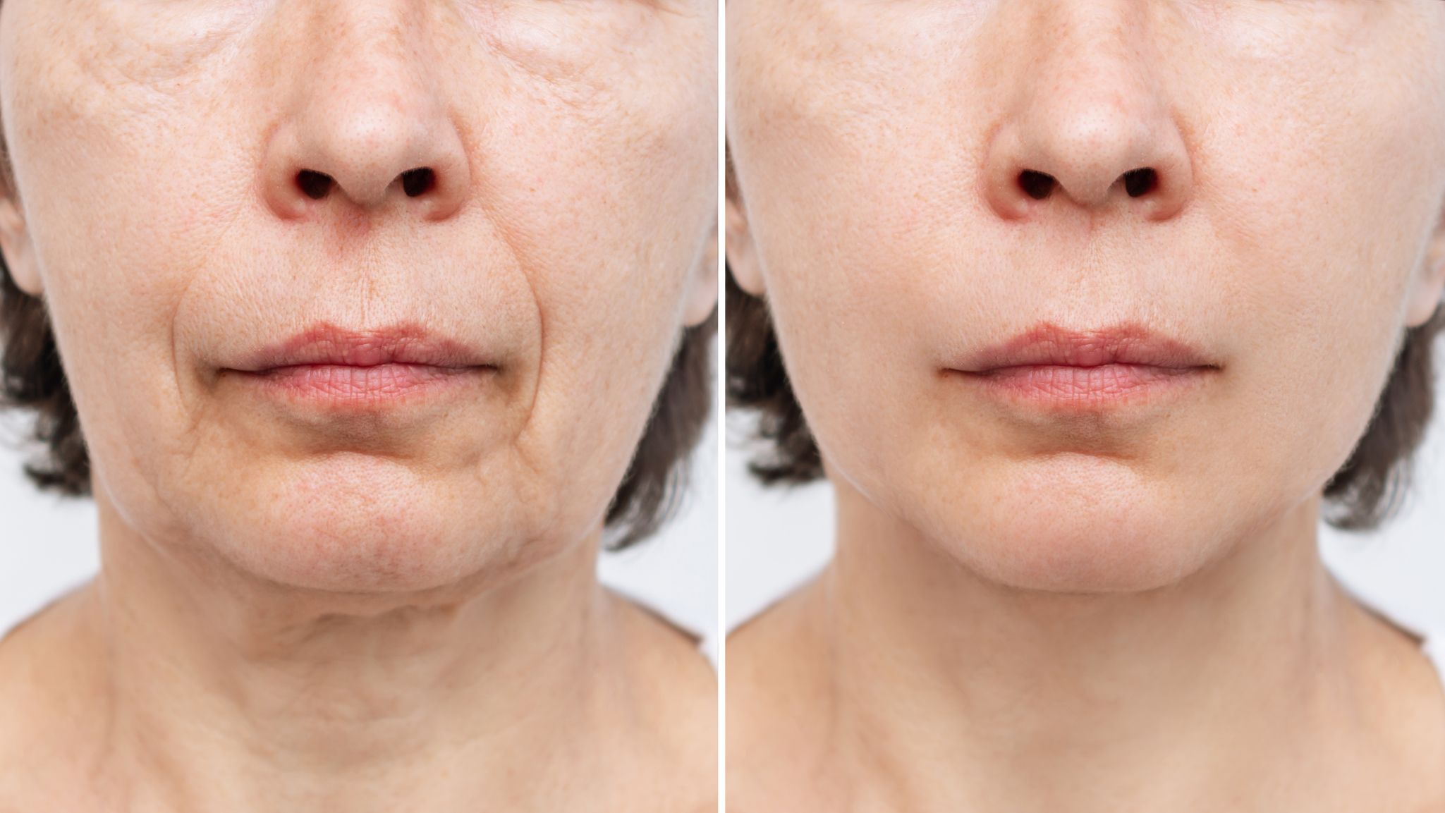 Tightening and Firming Saggy Loose Skin on The Face, Neck and Body – Skin  Type Solutions