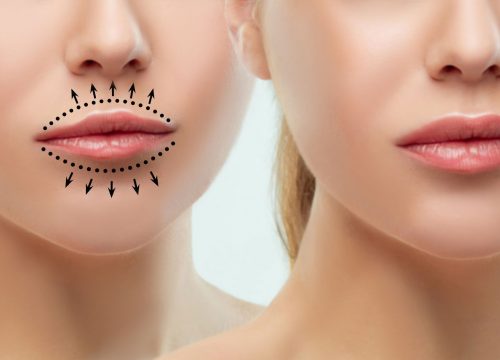 Woman's thin lips