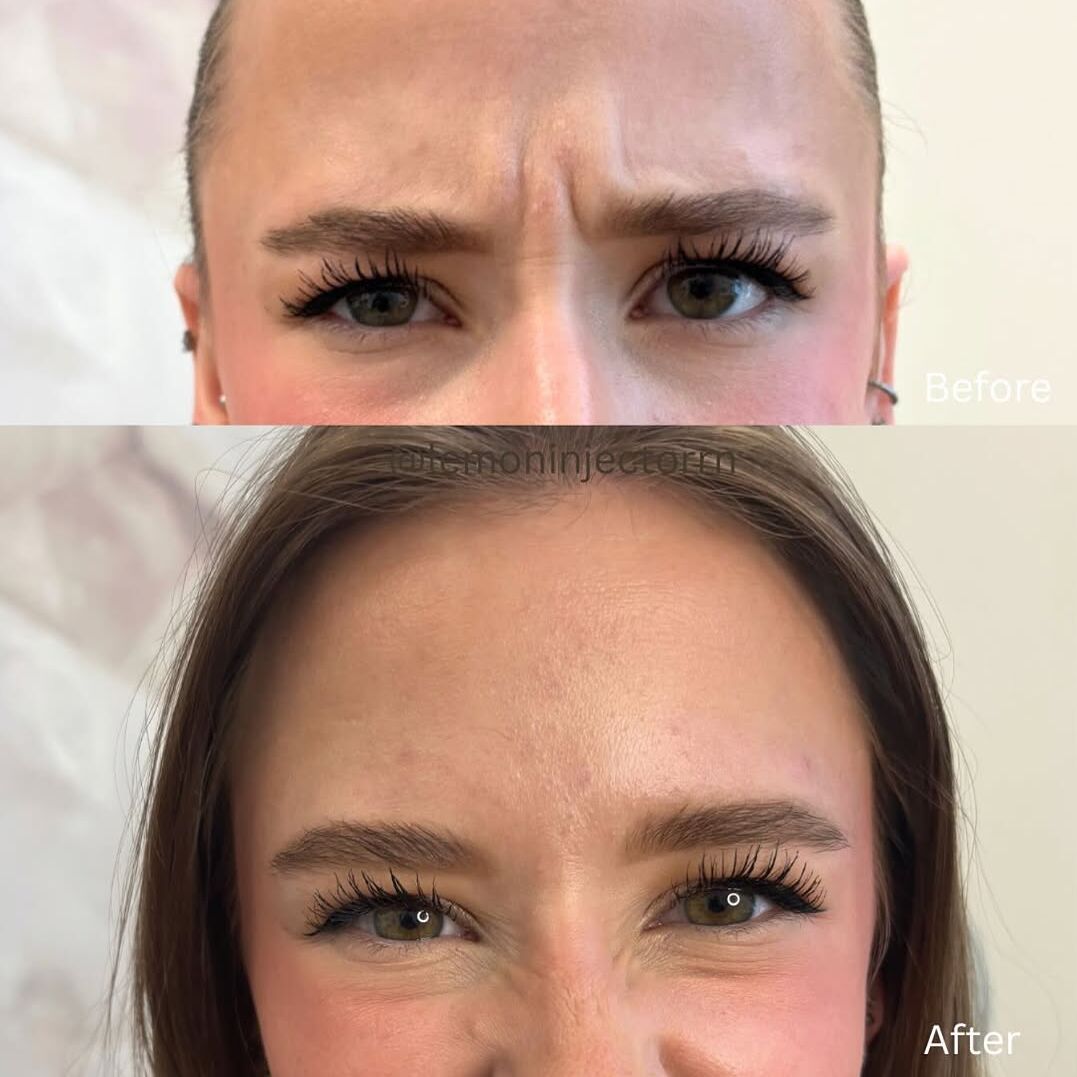 Done by @lemoninjectorrn